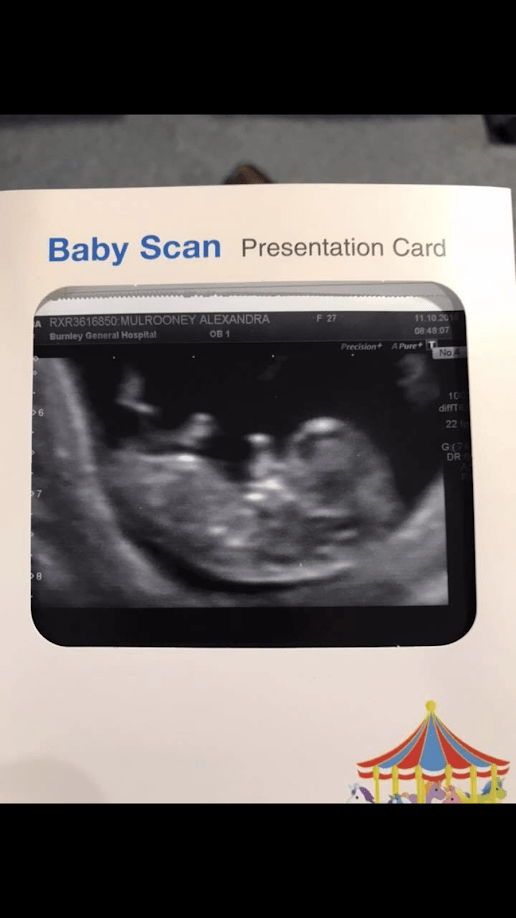 Our first baby scan photo.